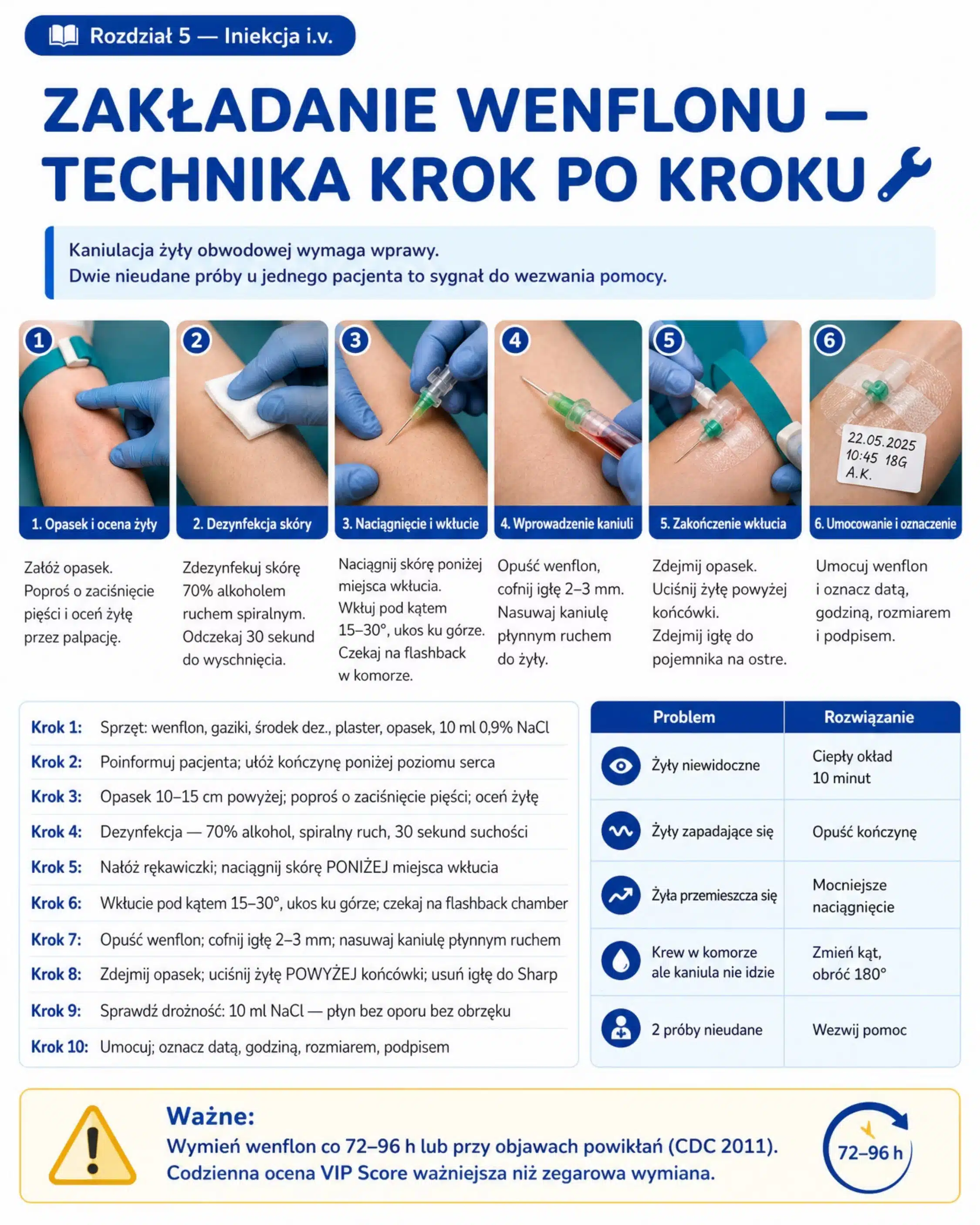 Zakładanie wenflonu technika krok po kroku
