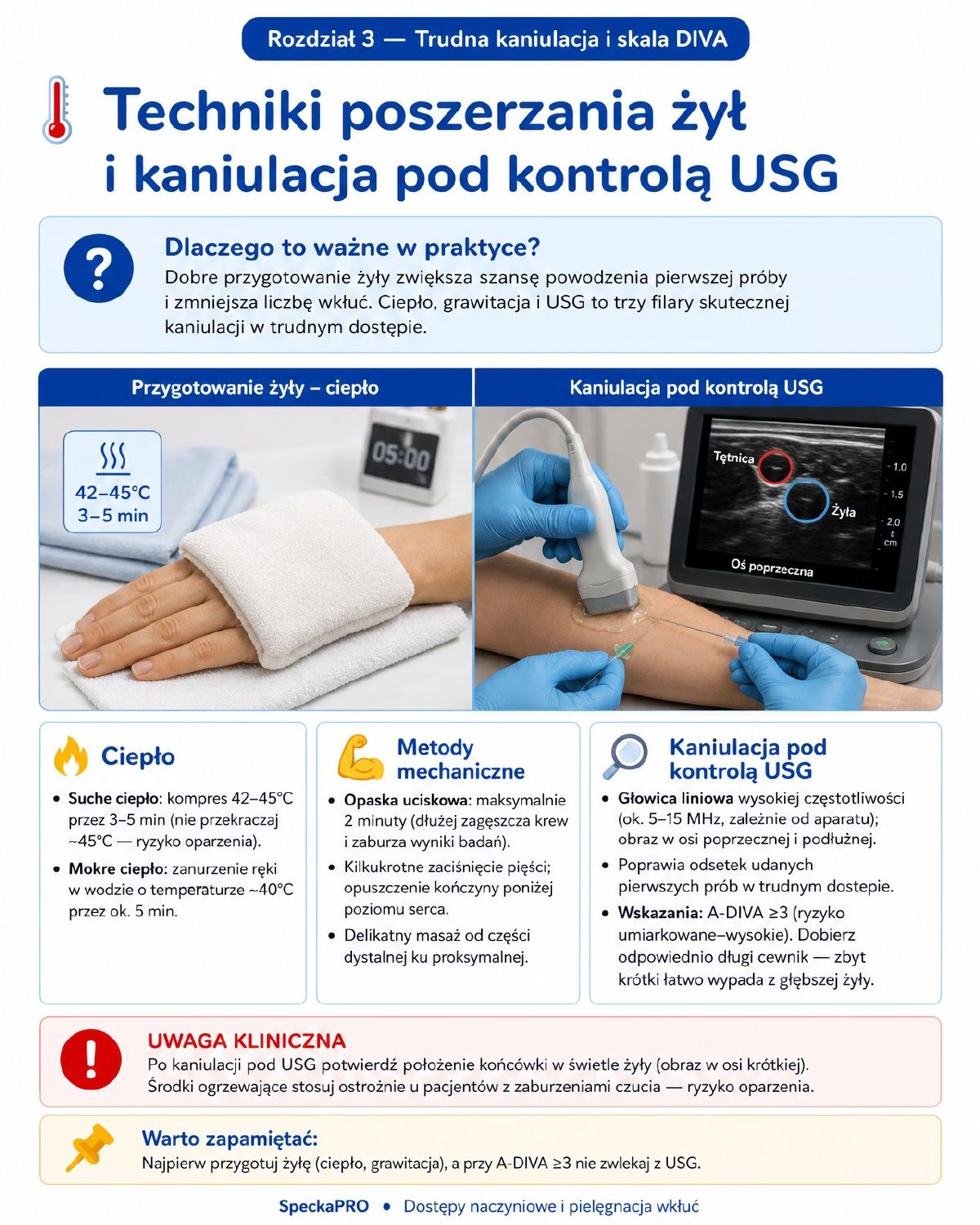Kaniulacja USG-guided głowica liniowa technika in-plane trudna kaniulacja